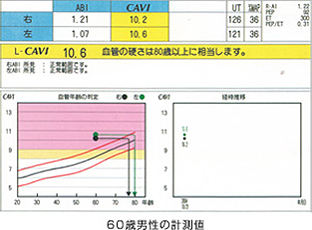 この検査でわかること